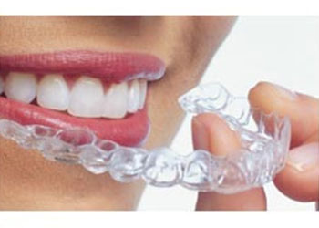 Invisalign Clear Braces in Redding and Yreka
