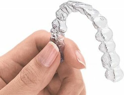 Invisalign: All It Has To Offer In Redding, CA