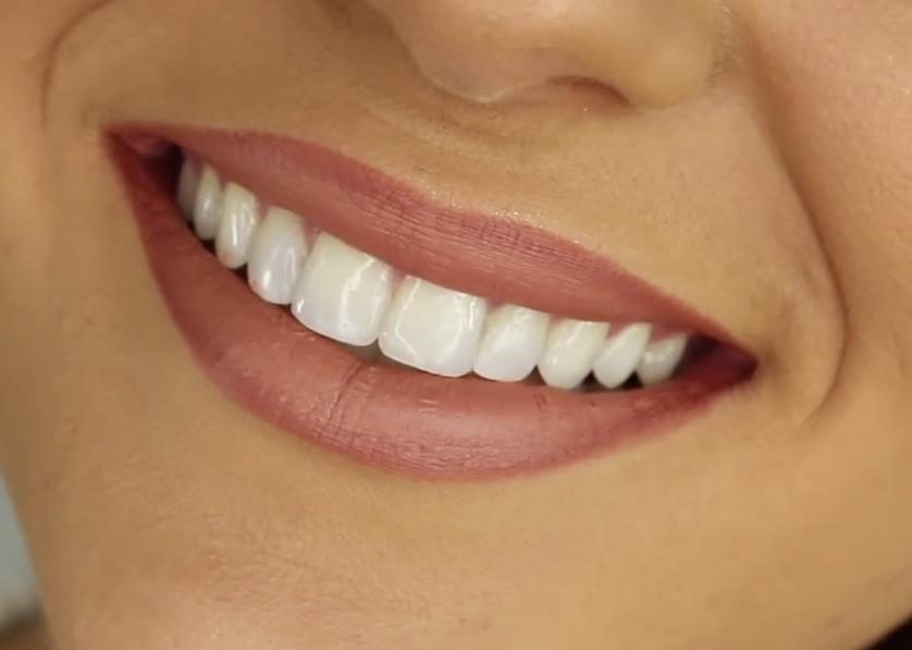 Tan-skinned woman with straight white teeth